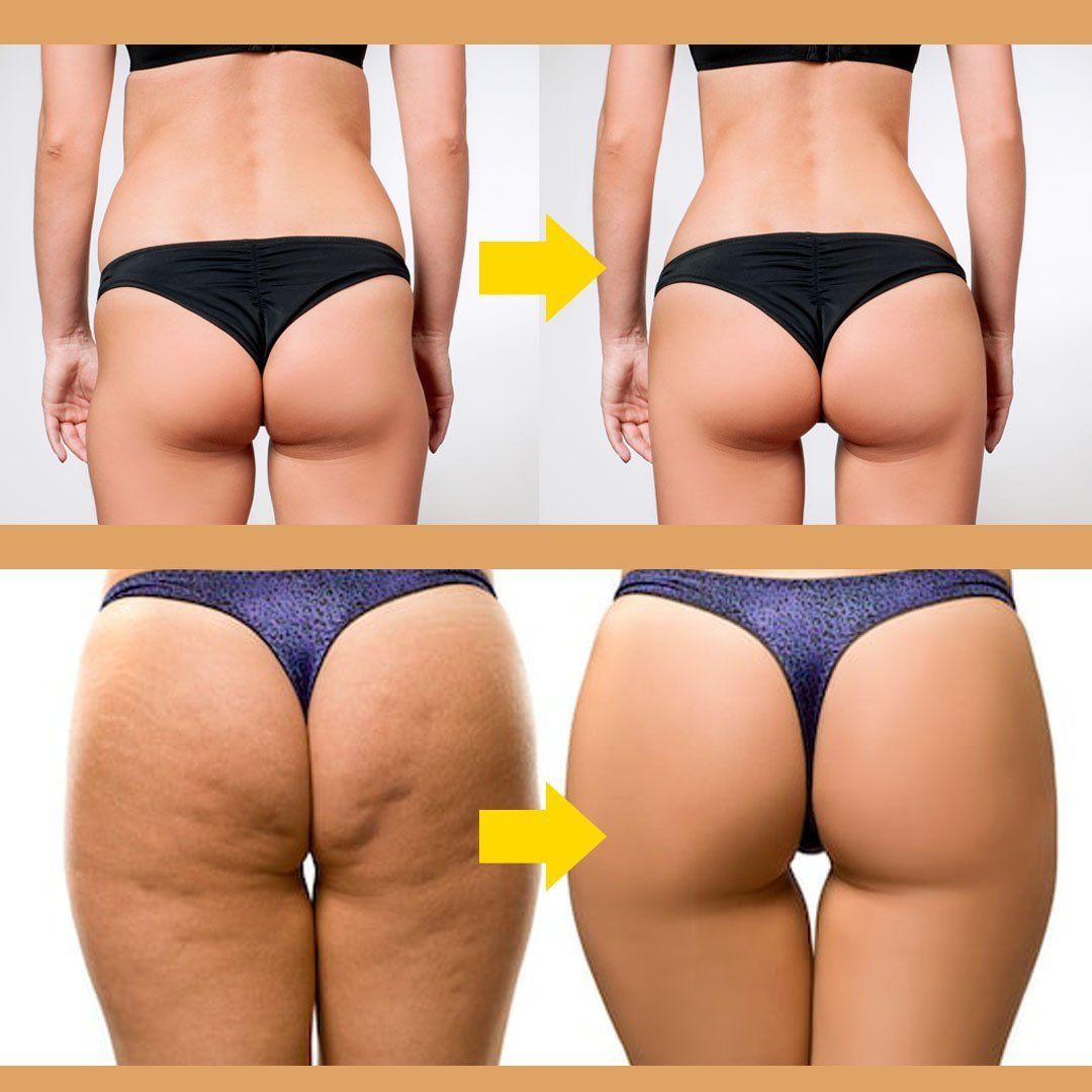 Butt Lift Shaping Patch (6pcs/set)