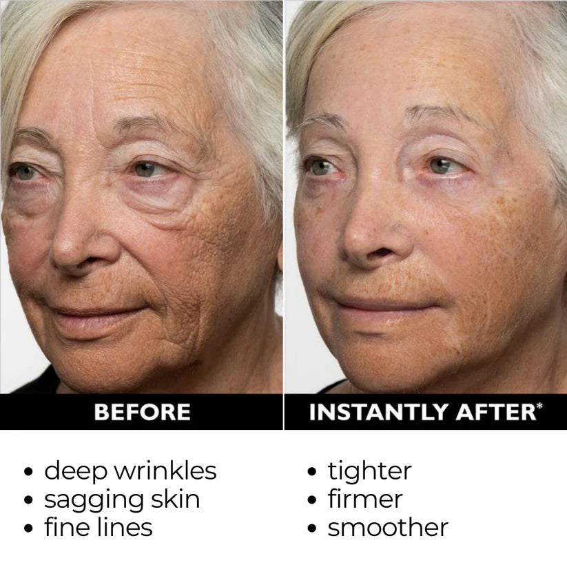 🔥Today 49% OFF✨Temporary Face Tightener