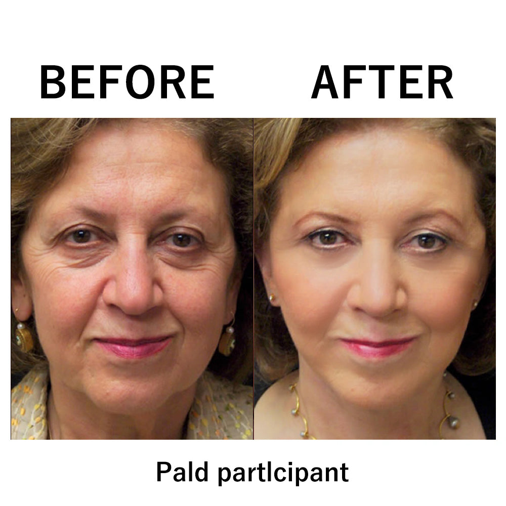 🔥Today 49% OFF✨Temporary Face Tightener