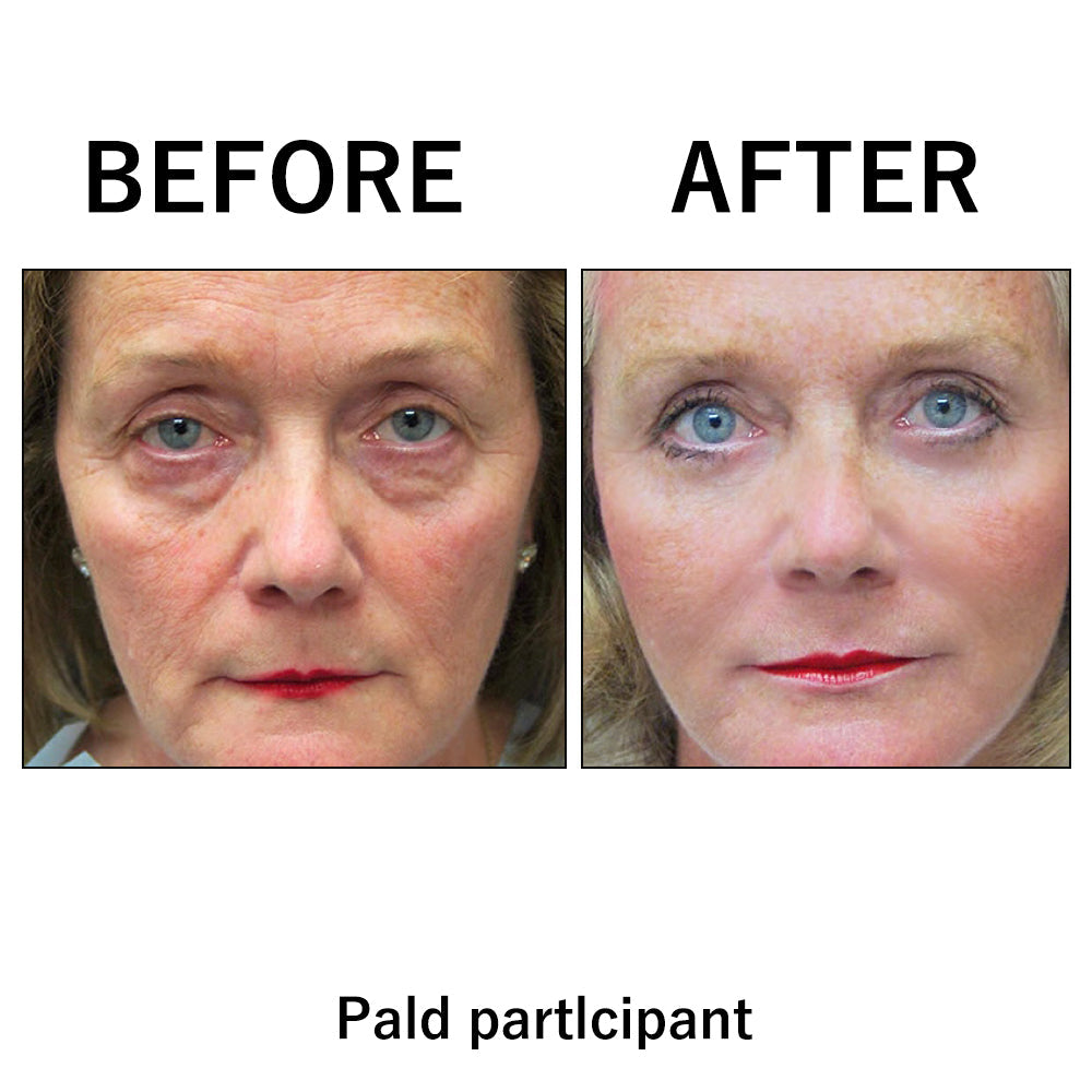 🔥Today 49% OFF✨Temporary Face Tightener