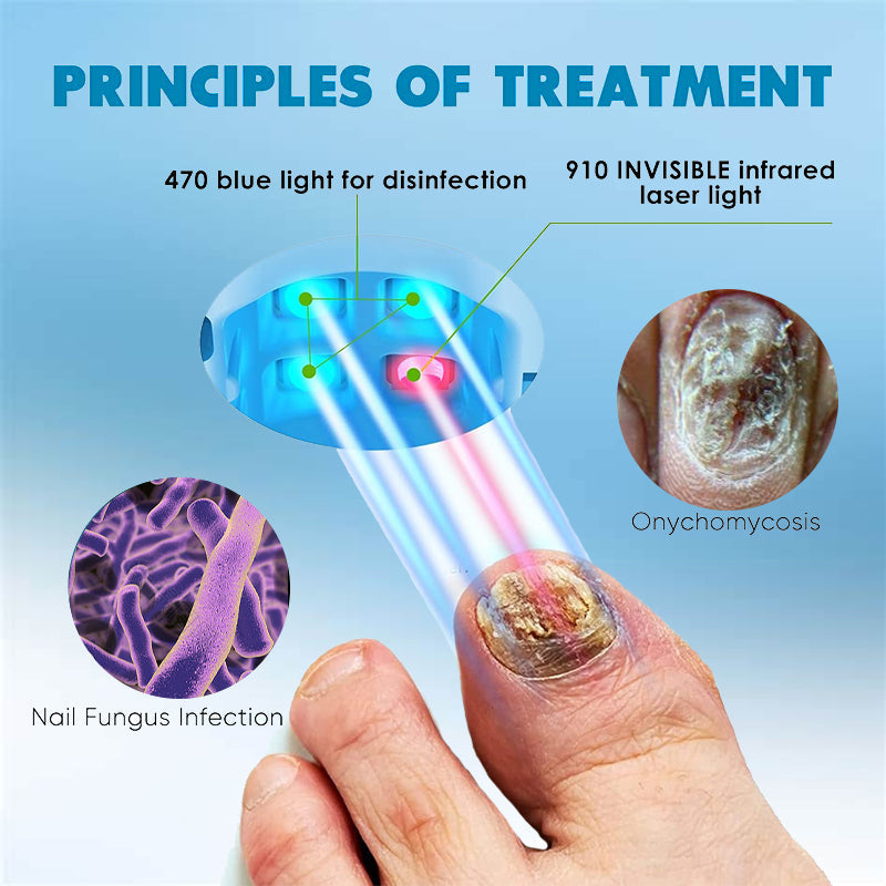 🔥(Official Mall)💖ODALIT™ Revolutionary High-Efficiency Light Therapy Device For Toenail Diseases-🗽Made and Shipped from USA 🔥