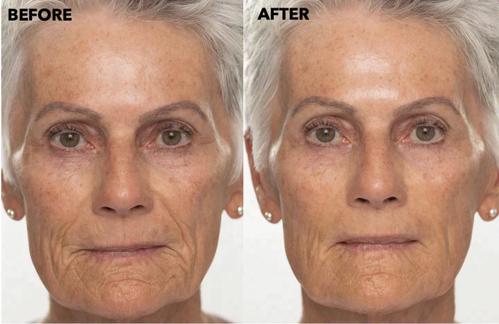 ✨Double Retinol & Collagen Peptide Serum Treatment
