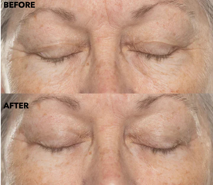 ✨Double Retinol & Collagen Peptide Serum Treatment