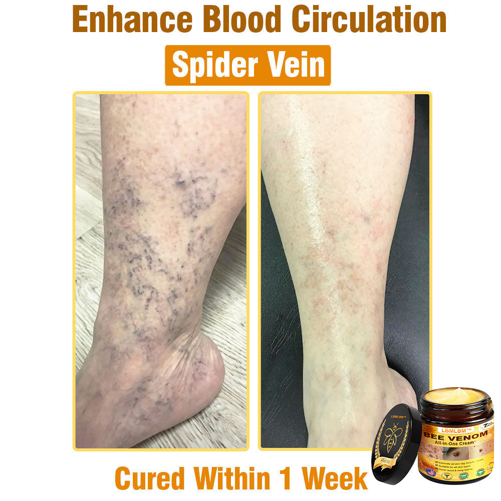 LBMLBM™ Bee Venom All-in-One Cream US Dermatologist Approved