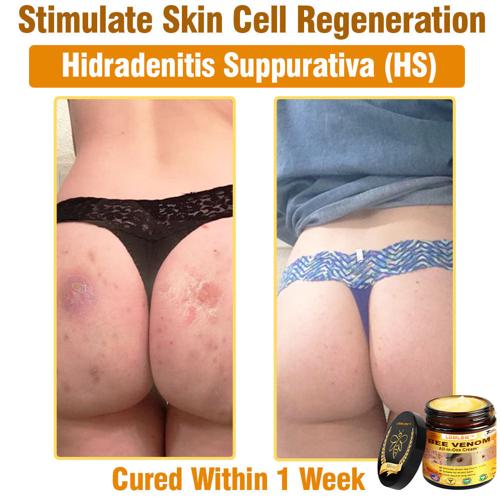 LBMLBM™ Bee Venom All-in-One Cream US Dermatologist Approved