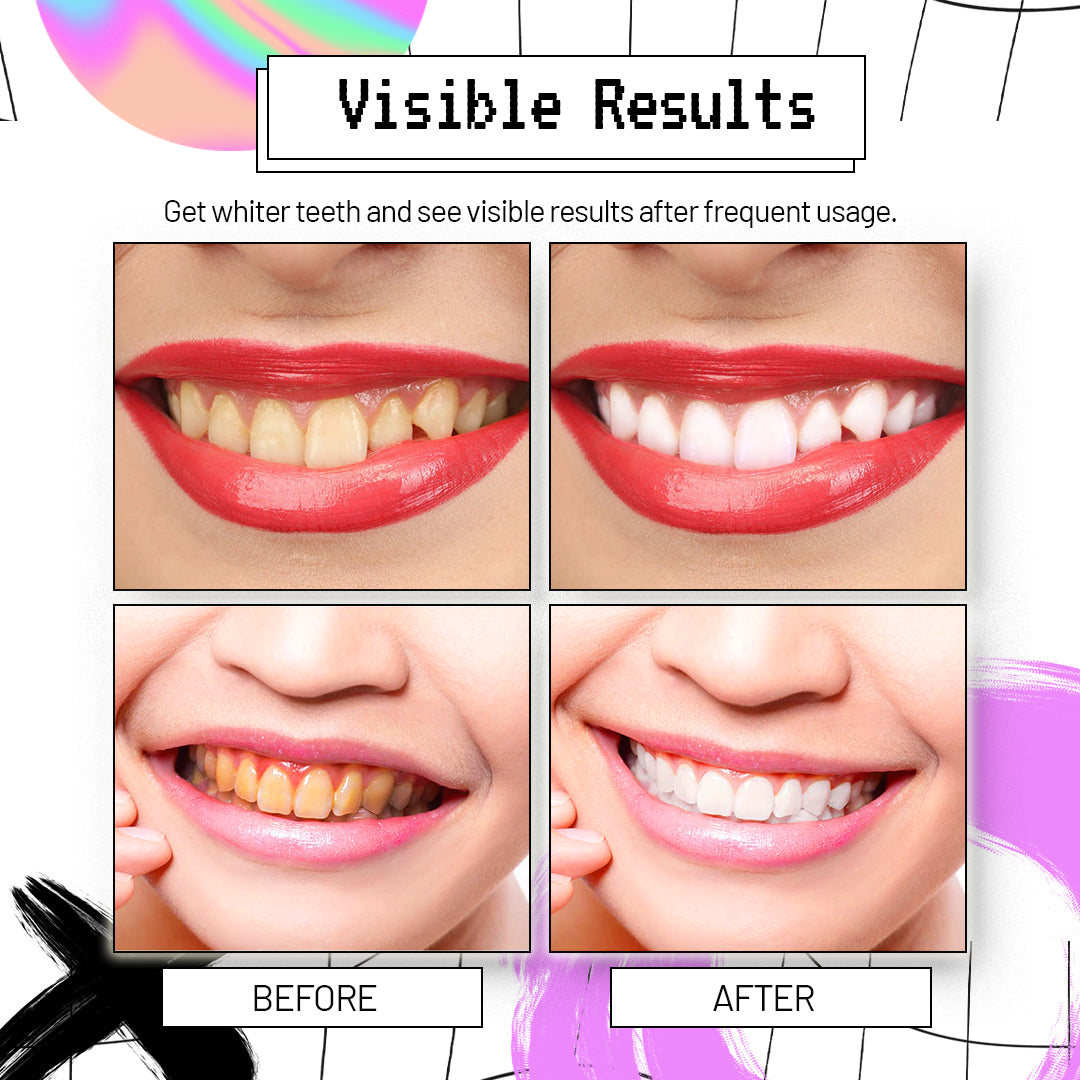 AngelSmile Whitening Purple Serum Toothpaste