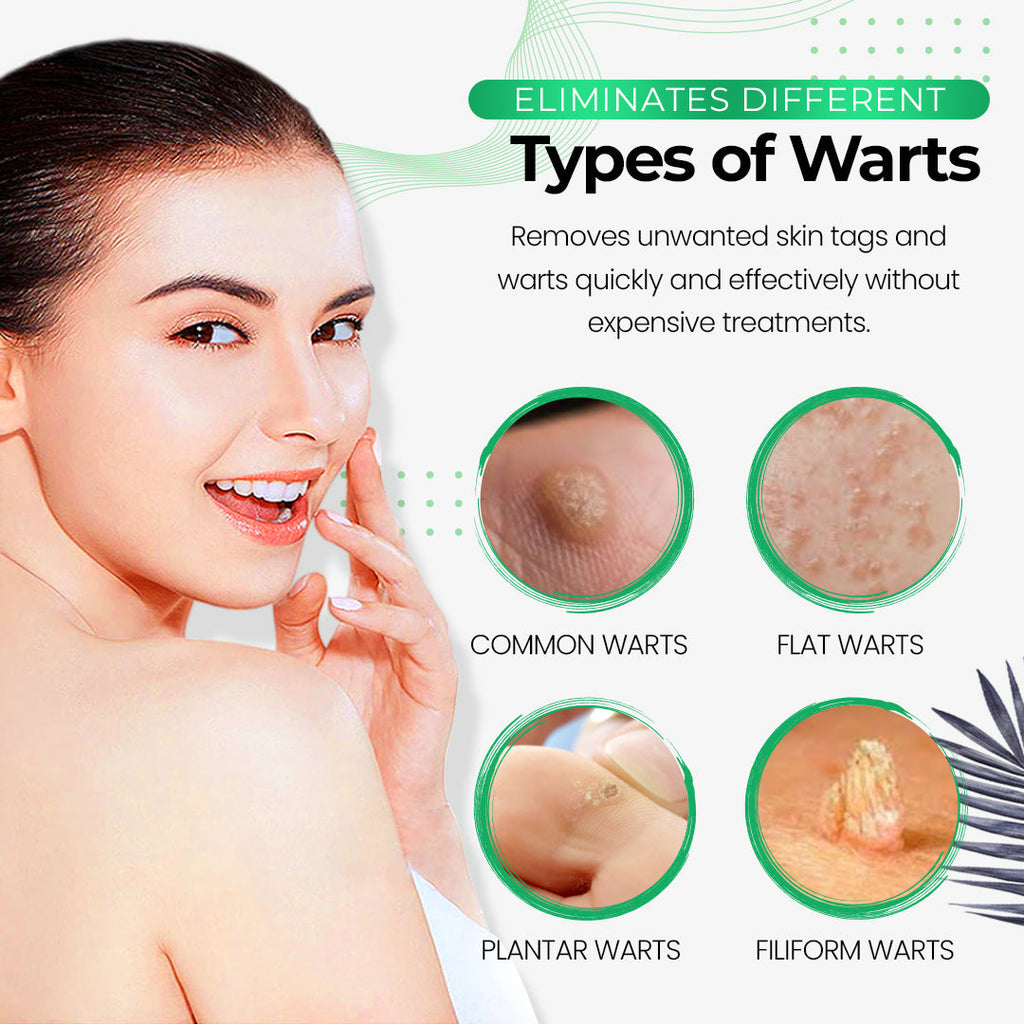 🎁Last Day Promotion 40% OFF - SmoothSkin™ Wart Eliminator Soap