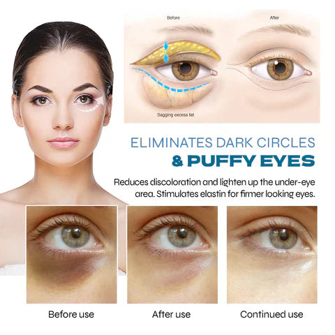 Zakdavi™ PEPTIDE Depuffing Eye Serum 🔥SALE 80% OFF 🔥