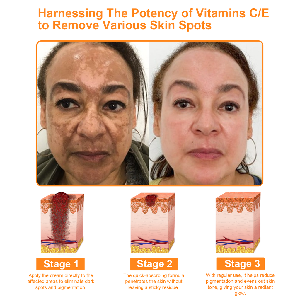 ODALIT™ 7-Day Multi-Effect All-in-One Skincare Cream (👨‍⚕️AAD Recommended)