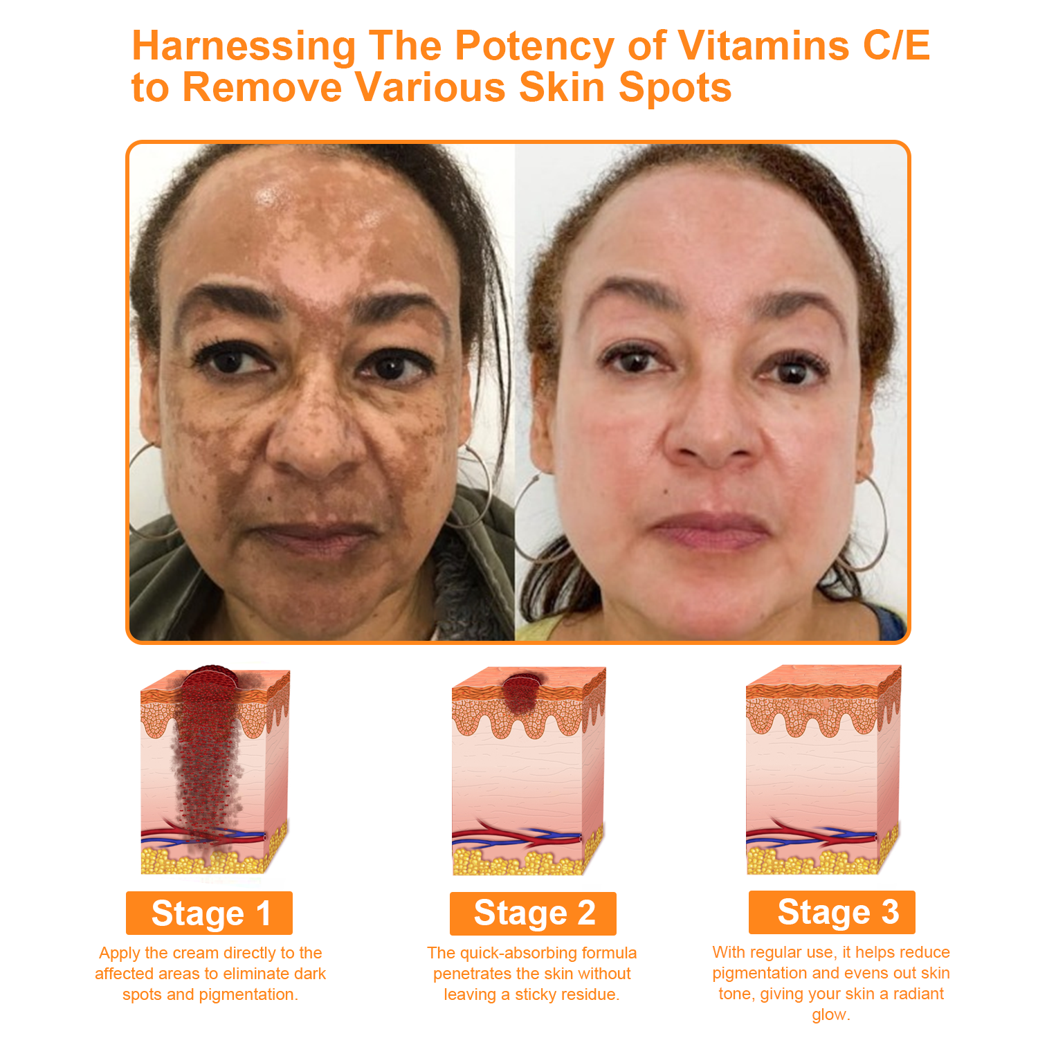 ODALIT™ 7-Day Multi-Effect All-in-One Skincare Cream (👨‍⚕️AAD Recommended)