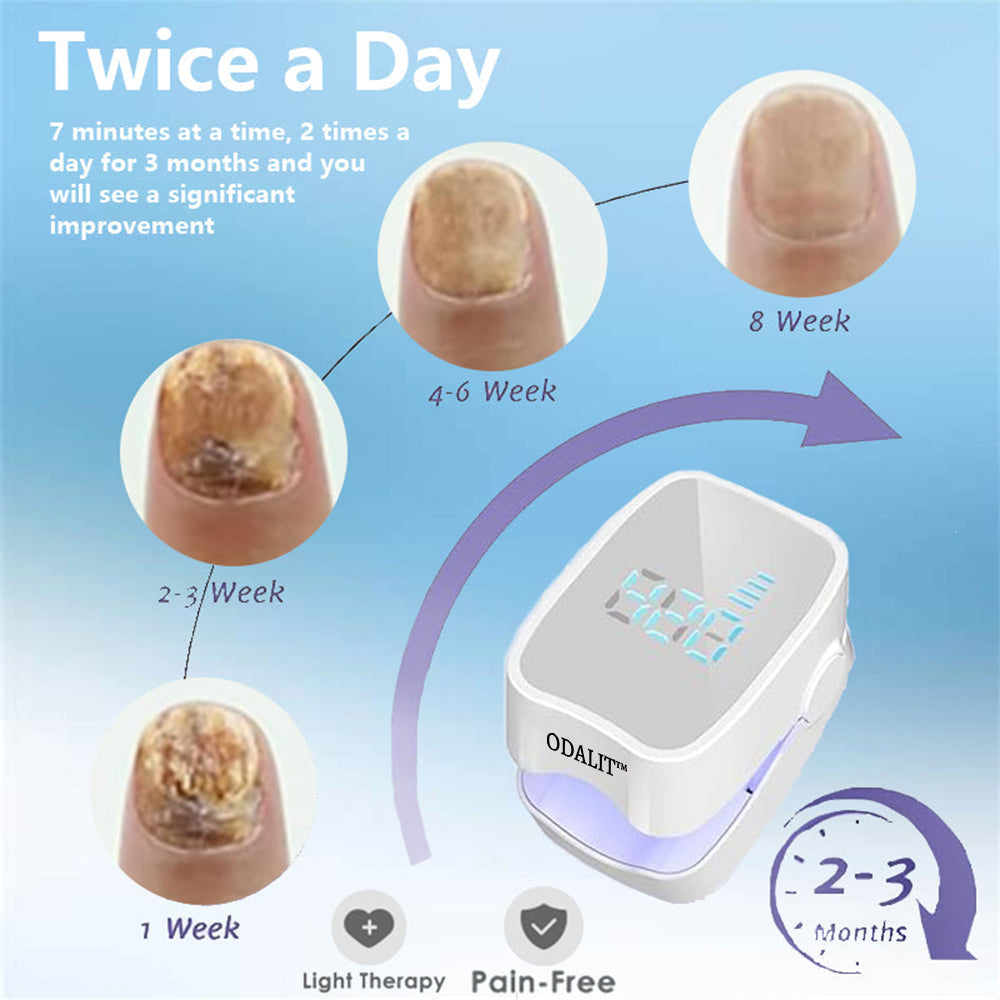 🔥(Official Mall)💖ODALIT™ Revolutionary High-Efficiency Light Therapy Device For Toenail Diseases-🗽Made and Shipped from USA 🔥