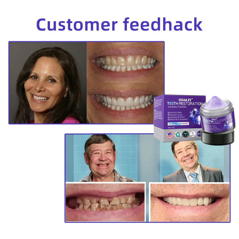 🎁Flash Sale - Don’t Miss Out - ODALIT™ TeethRestoration Mineral Powder🦷(ADA recommended)👩‍⚕️(Treats periodontitis and mouth ulcers, prevents tooth loss, and repairs gum recession)
