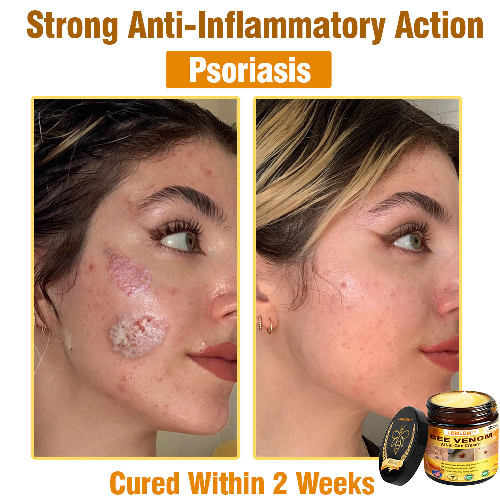 LBMLBM™ Bee Venom All-in-One Cream US Dermatologist Approved