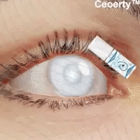 Seurico™ FDA-Certified Comprehensive Eye Care Drops