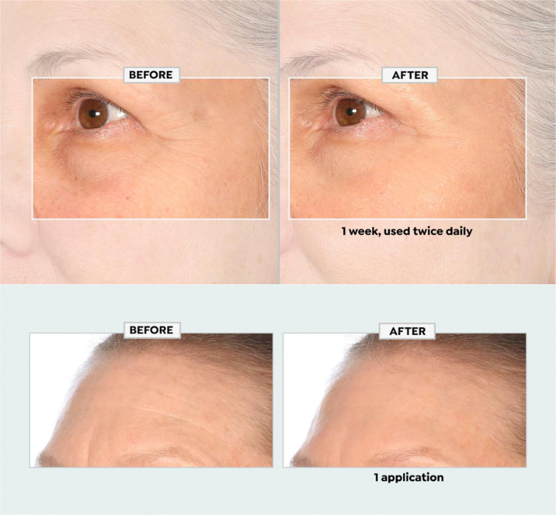 ✨Double Retinol & Collagen Peptide Serum Treatment