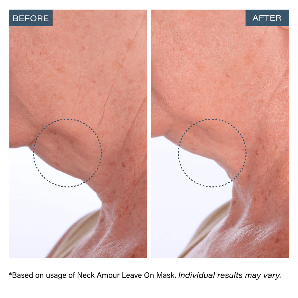 ✨Neck Amour Leave-On Neck Mask