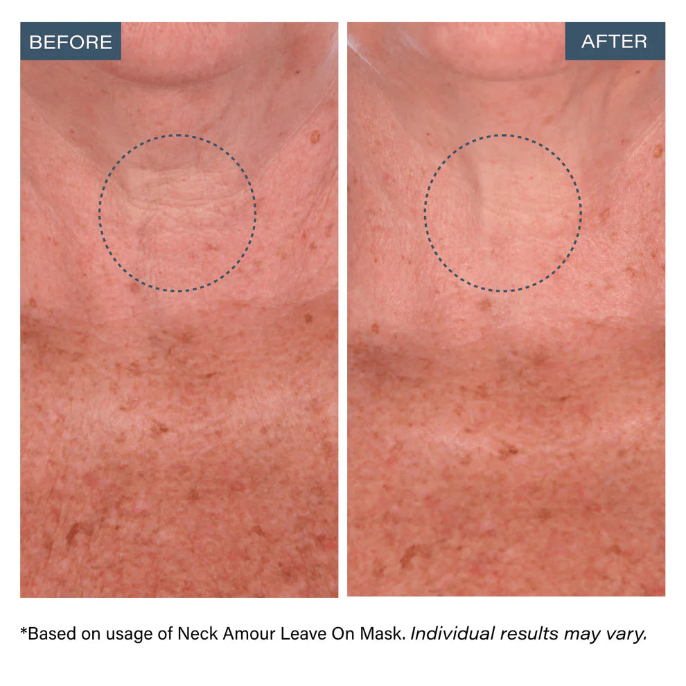 ✨Neck Amour Leave-On Neck Mask