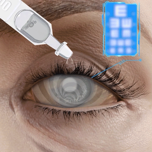 Seurico™ Eye Drops for Presbyopia Rehabilitation