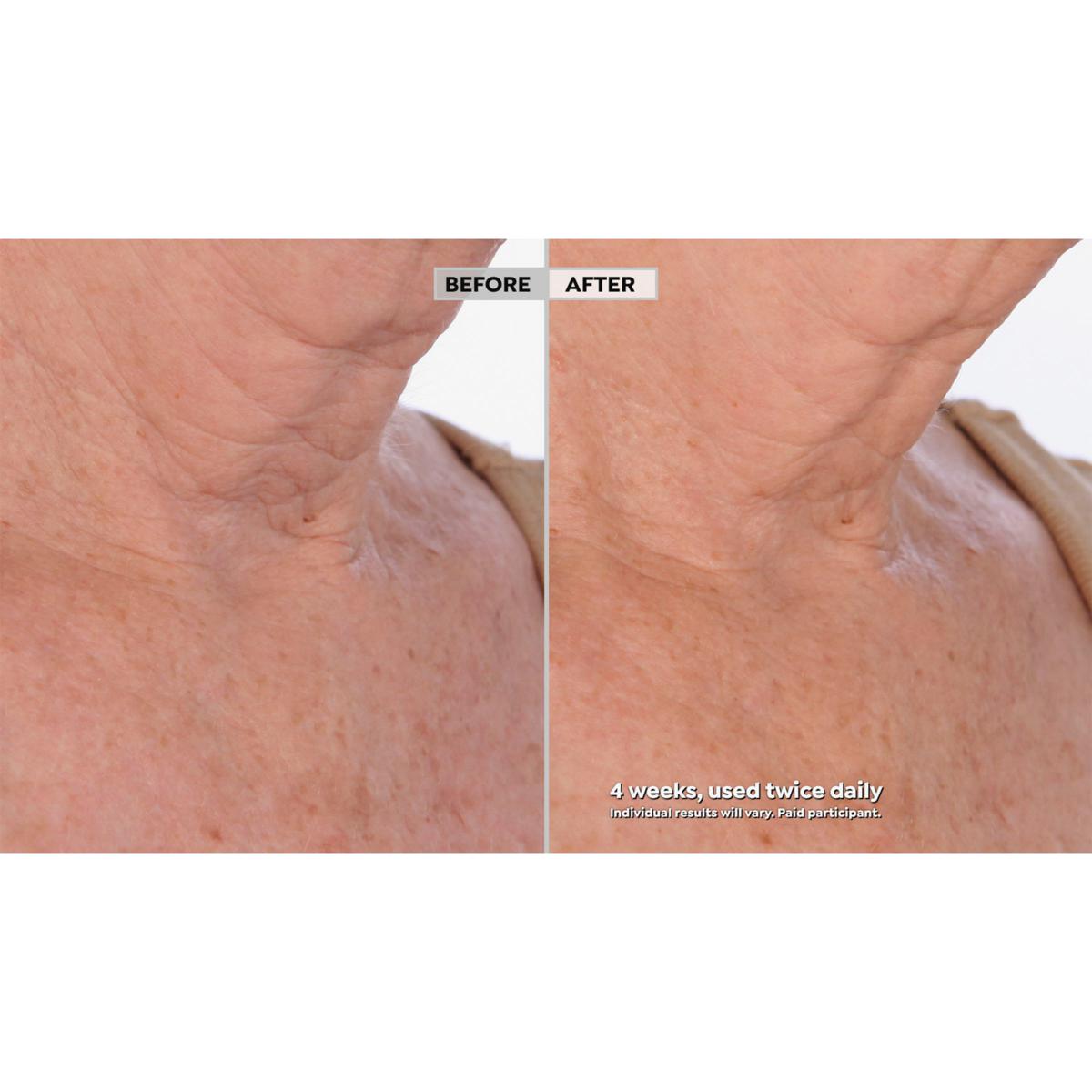 ✨Neck Amour Leave-On Neck Mask