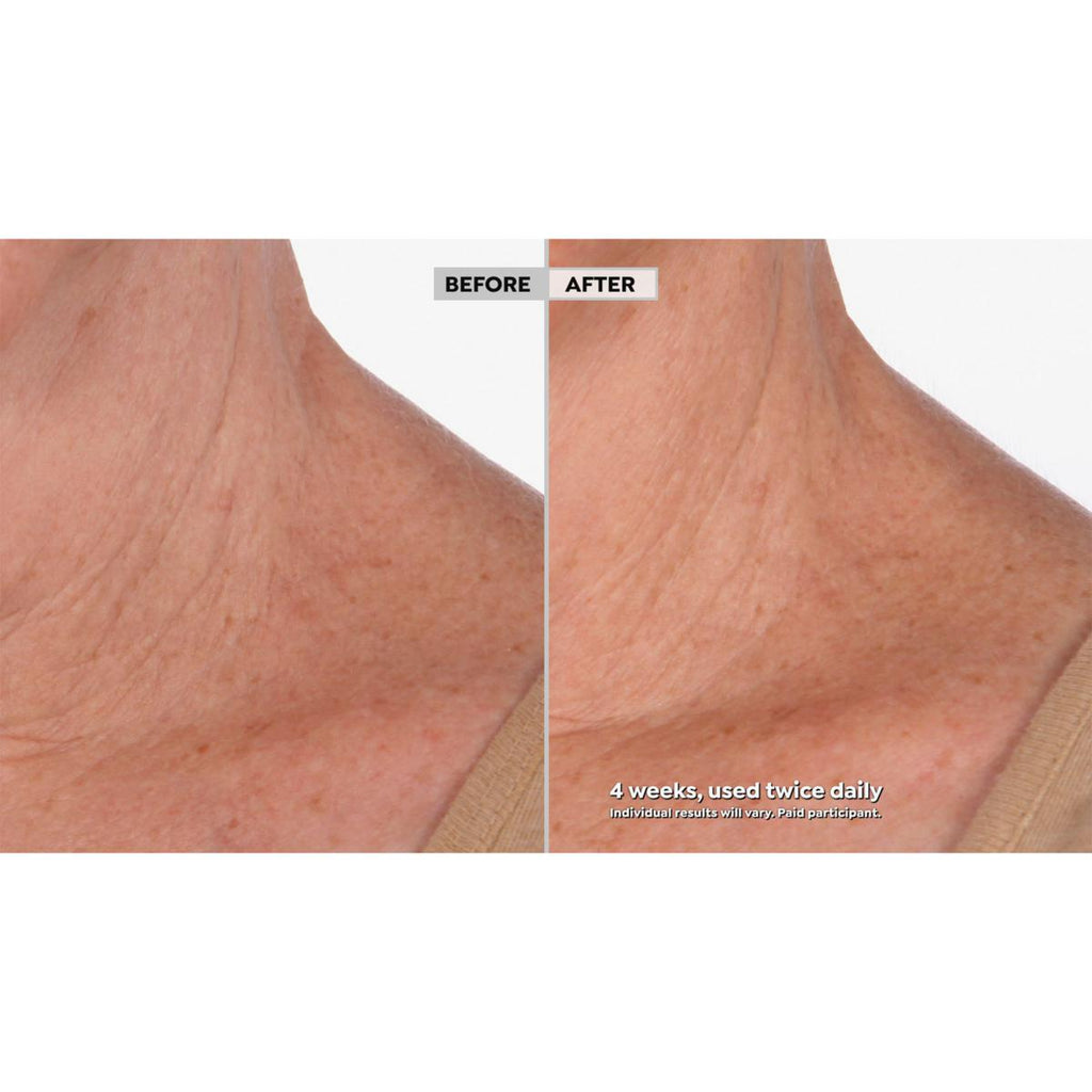 ✨Neck Amour Leave-On Neck Mask