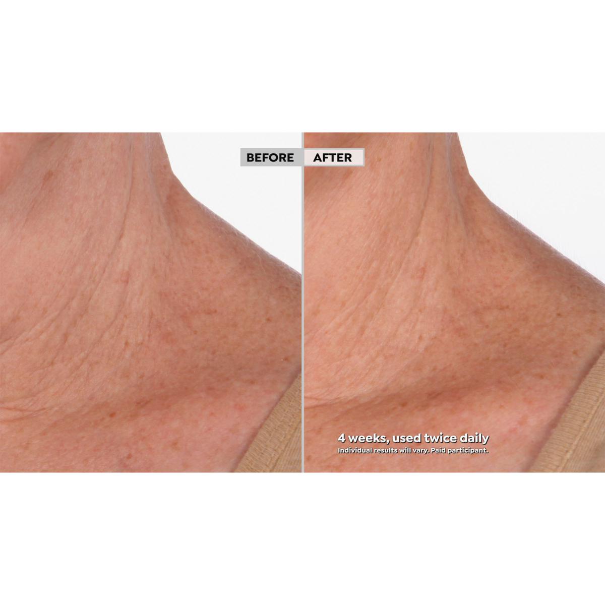 ✨Neck Amour Leave-On Neck Mask