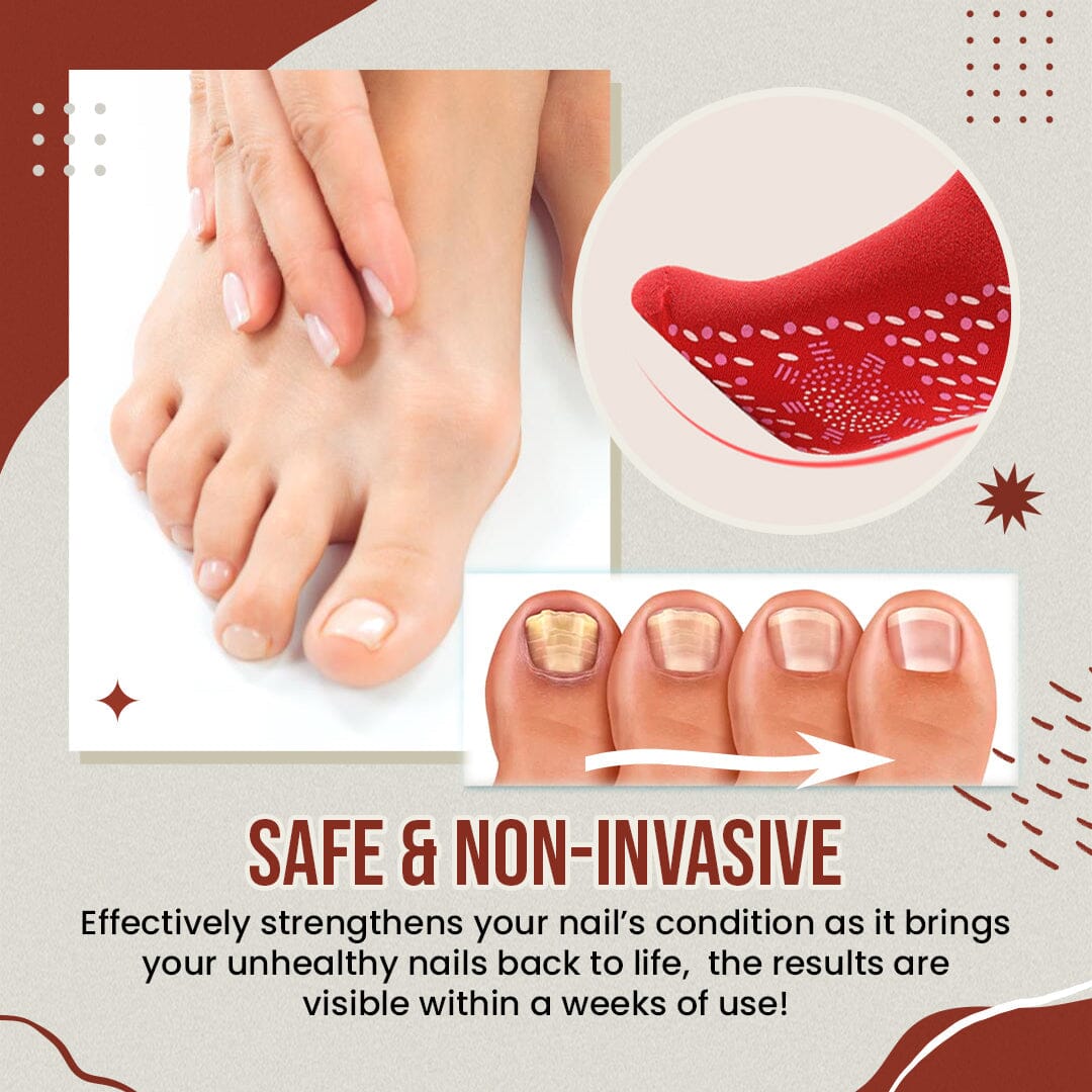 Anti-Onychomycosis Socks