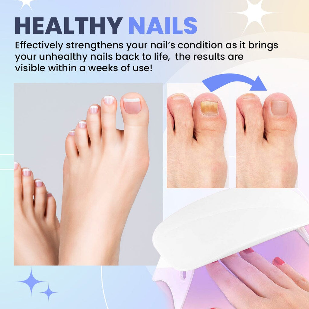 NailPro™ Nail Fungus Light Therapy Device