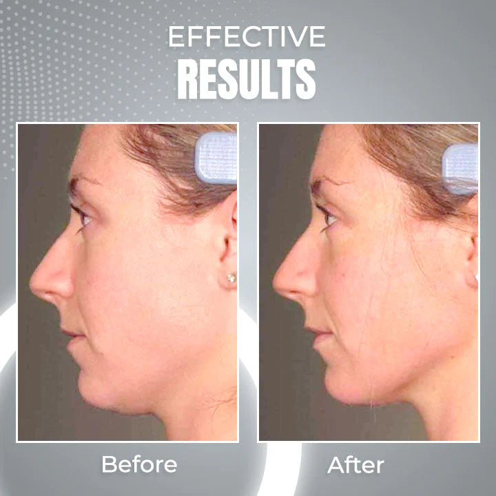 ContourPro™ Sleeping V-Face Beauty Device