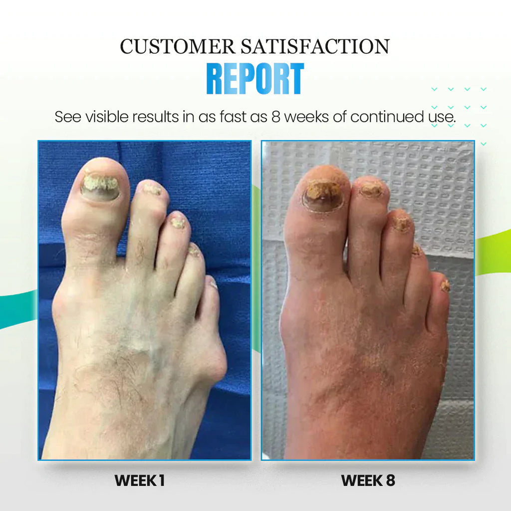 Sofeet™ Anti-Bunions Health Socks