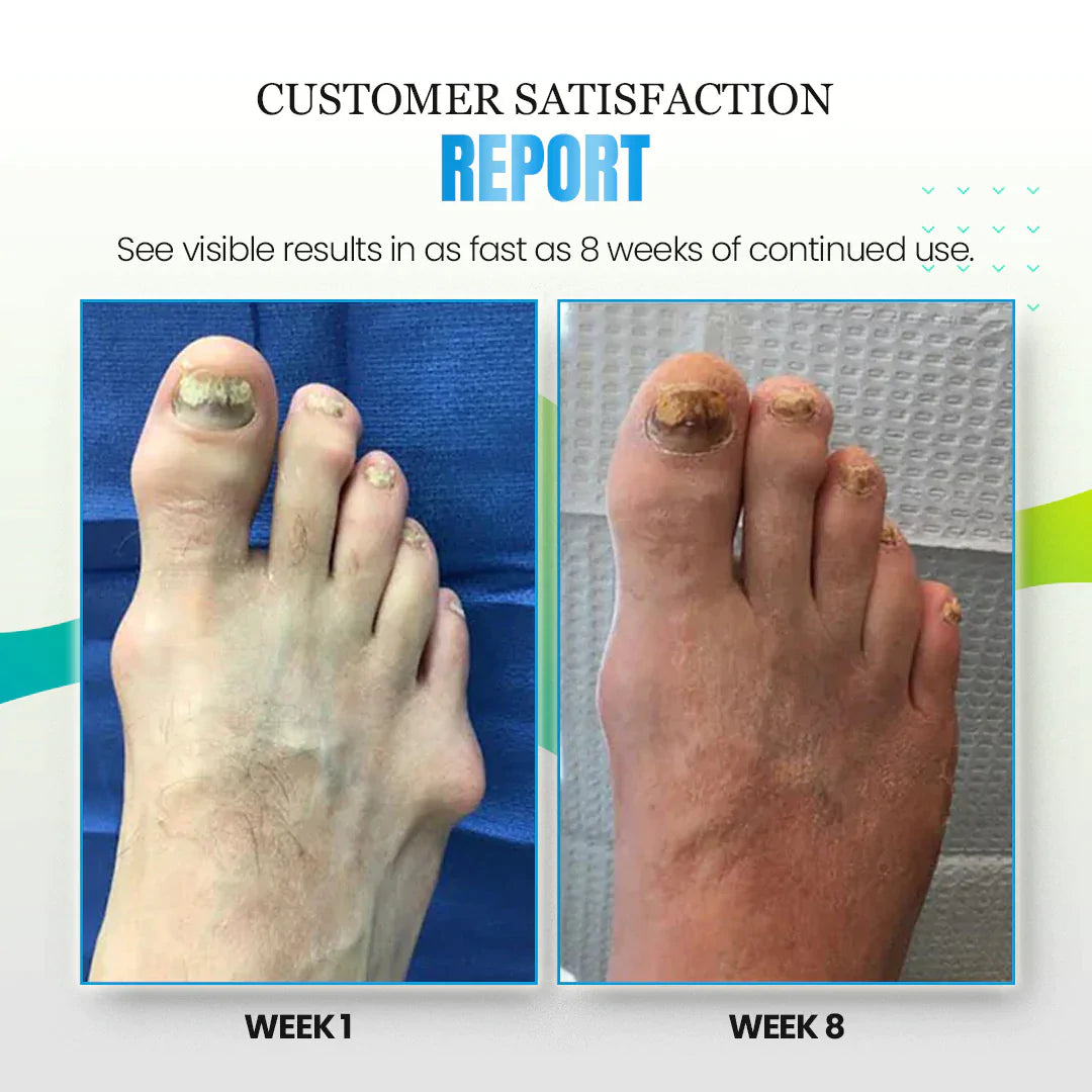 Sofeet™ Anti-Bunions Health Socks