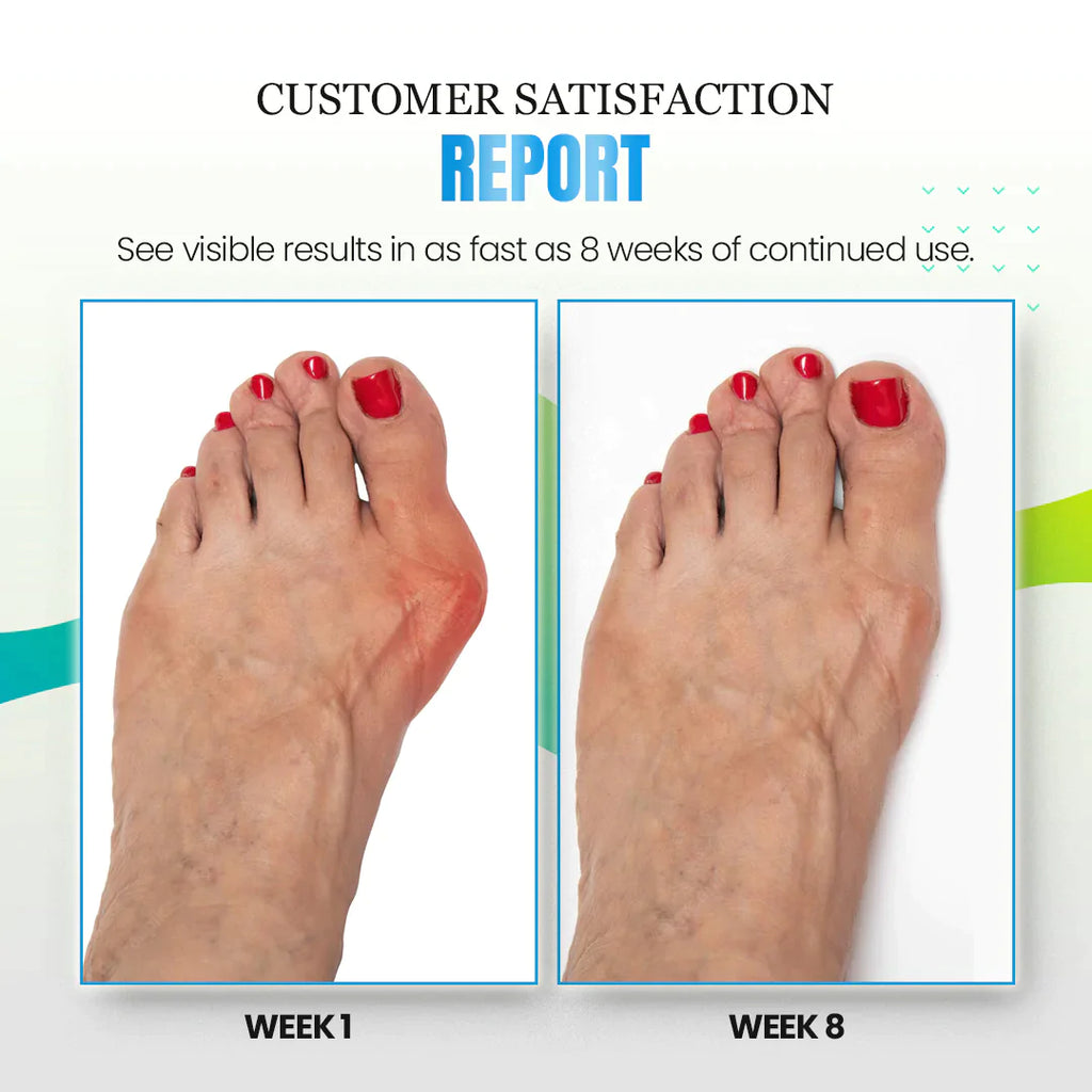 Sofeet™ Anti-Bunions Health Socks